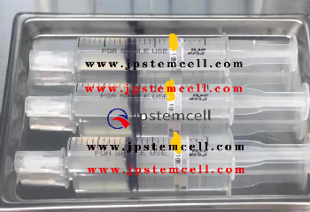 客人案例：B12干细胞治疗卵巢早衰,计划要 二胎
